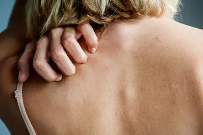Skin Diseases - Environment, Dust, Heavy metals - Zeolite Knowledge