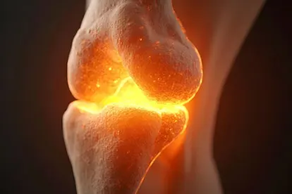 Zeolite – Osteoporosis – Overview – Bone Loss, Women-Menopause , Calcium Zeolite - Osteoporosis - Overview - Bone Loss, Women-Menopause , Calcium