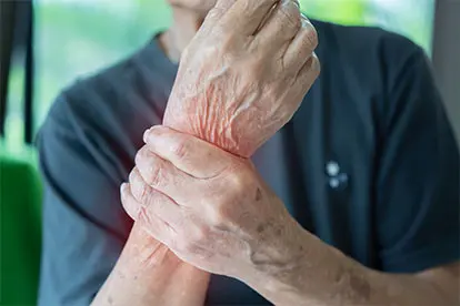 Zeolite - Rheumatism, Arthritis, Lupus, Gout