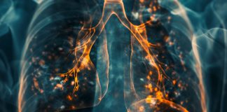 COPD-Krankheit - Umweltgifte - Mikroplastik