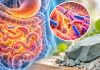 SIBO - Small Intestinal Bacterial Overgrowth - update